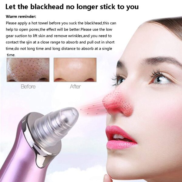 Electric Blackhead Remover Pore Vacuum Suction - Image 6