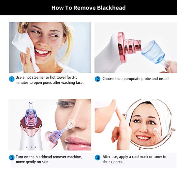 Electric Blackhead Remover Pore Vacuum Suction - Image 10