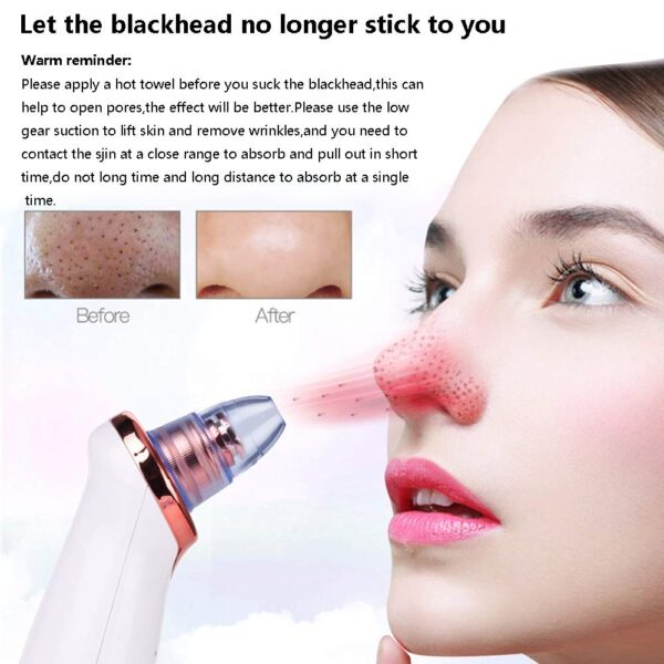 Electric Blackhead Remover Pore Vacuum Suction - Image 8